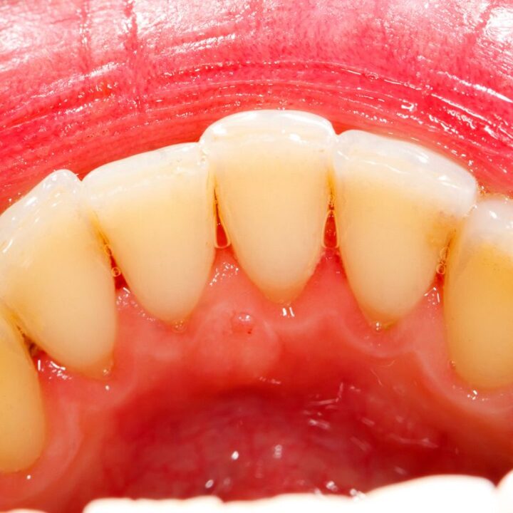stomatologija posle